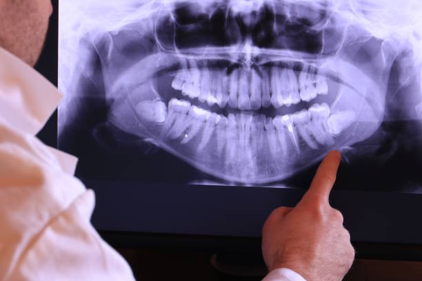 Best Weekend Emergency Dentist in Untain View, MO