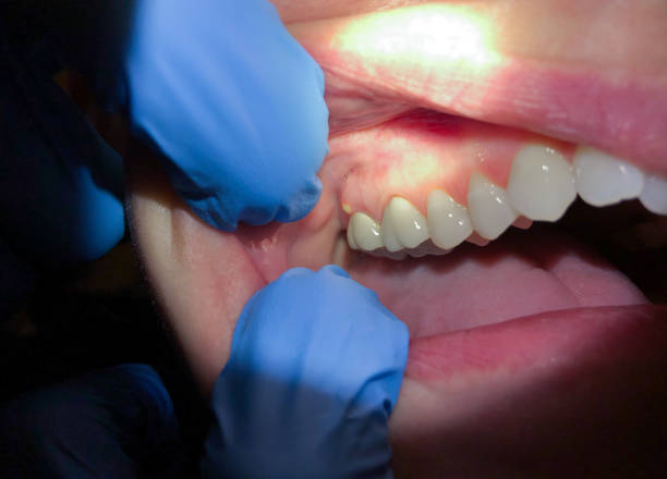 Best Pediatric Emergency Dentist in Untain View, MO
